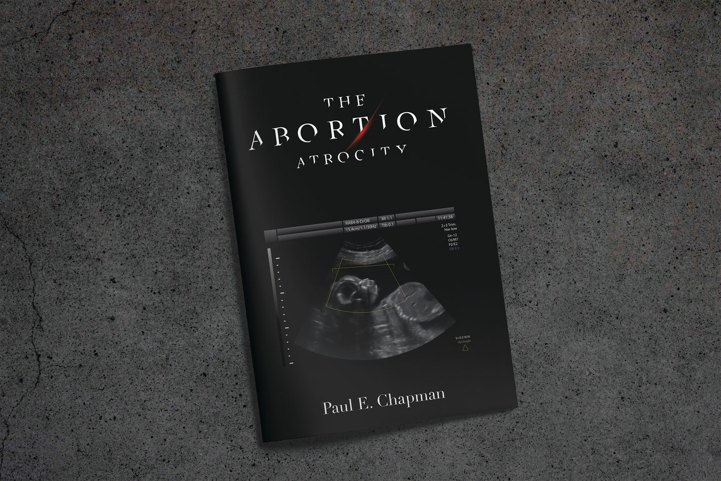 The Abortion Atrocity Mini Book